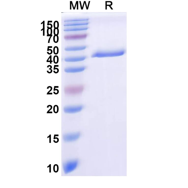 SDS-PAGE - Anti-PLAC1 Nanobody [SAA2073] (A338278) - Antibodies.com