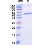 SDS-PAGE - Anti-PLAC1 Nanobody [SAA2073] (A338278) - Antibodies.com