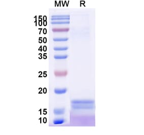 SDS-PAGE - Anti-C Reactive Protein Nanobody [SAA2074] (A338279) - Antibodies.com