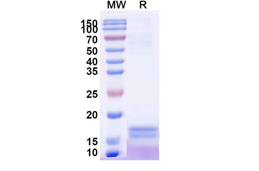 SDS-PAGE - Anti-C Reactive Protein Nanobody [SAA2074] (A338279) - Antibodies.com
