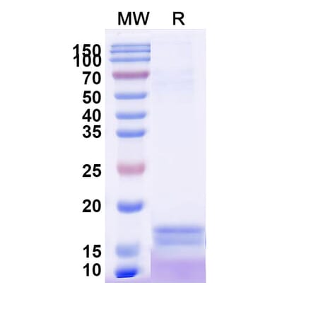 SDS-PAGE - Anti-C Reactive Protein Nanobody [SAA2074] (A338279) - Antibodies.com