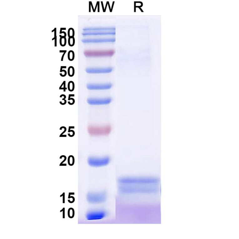 SDS-PAGE - Anti-C Reactive Protein Nanobody [SAA2074] (A338279) - Antibodies.com