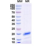 SDS-PAGE - Anti-Albumin Nanobody [ALB8] (A338285) - Antibodies.com