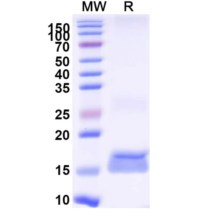 SDS-PAGE - Anti-VCAM1 Nanobody [cAbVCAM1-5] (A338287) - Antibodies.com