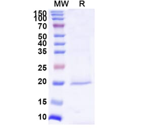 SDS-PAGE - Anti-Mesothelin Nanobody [YE-17] (A338289) - Antibodies.com