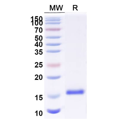SDS-PAGE - Anti-LAG 3 Nanobody [Clone:3132] (A338290) - Antibodies.com