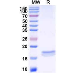 SDS-PAGE - Anti-CXCL11 Nanobody [11A7] (A338291) - Antibodies.com