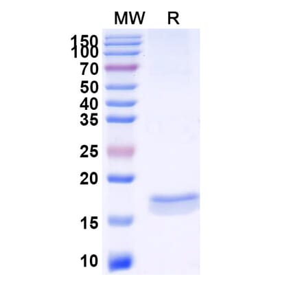 SDS-PAGE - Anti-CXCL11 Nanobody [11A7] (A338291) - Antibodies.com