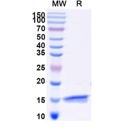 SDS-PAGE - Anti-TNFRSF1A Nanobody [Clone: 70] (A338292) - Antibodies.com