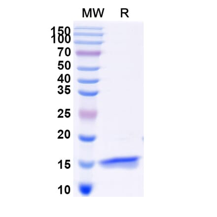 SDS-PAGE - Anti-TNFRSF1A Nanobody [Clone: 70] (A338292) - Antibodies.com