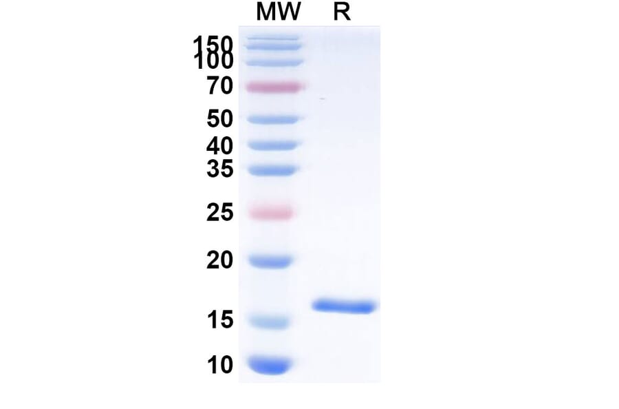 SDS-PAGE - Anti-CD16b Nanobody [C28] (A338295) - Antibodies.com