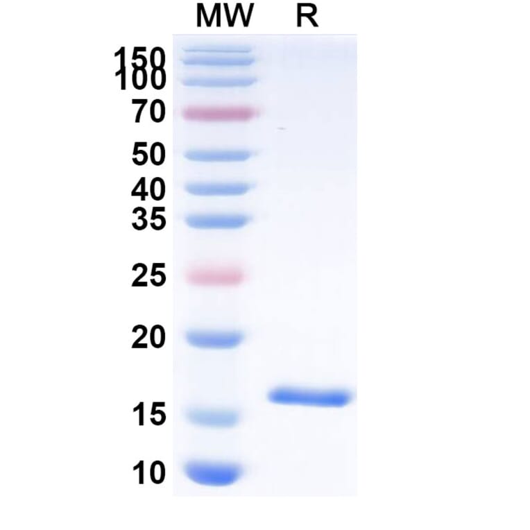SDS-PAGE - Anti-CD16b Nanobody [C28] (A338295) - Antibodies.com