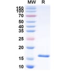 SDS-PAGE - Anti-CD16b Nanobody [C28] (A338295) - Antibodies.com