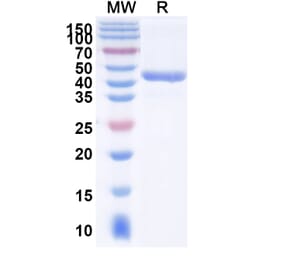 SDS-PAGE - Anti-TREM2 Nanobody [SAA2090] (A338304) - Antibodies.com