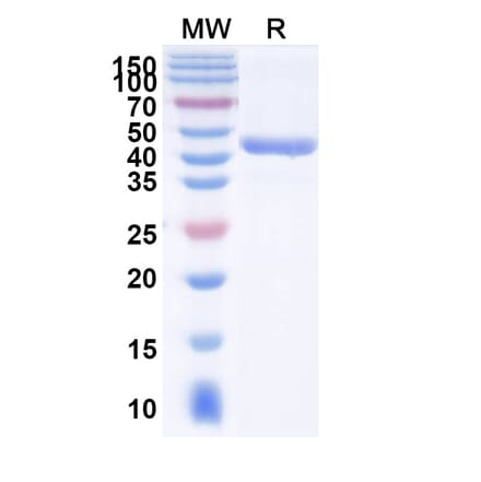 SDS-PAGE - Anti-TREM2 Nanobody [SAA2090] (A338304) - Antibodies.com