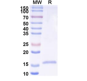 SDS-PAGE - Anti-Phosphoprotein Nanobody [SAA2104] (A338309) - Antibodies.com