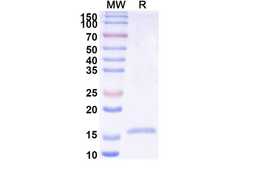 SDS-PAGE - Anti-Phosphoprotein Nanobody [SAA2104] (A338309) - Antibodies.com