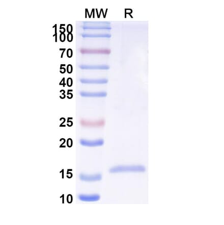 SDS-PAGE - Anti-Phosphoprotein Nanobody [SAA2104] (A338309) - Antibodies.com