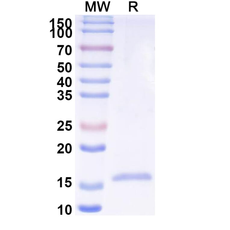 SDS-PAGE - Anti-Phosphoprotein Nanobody [SAA2104] (A338309) - Antibodies.com