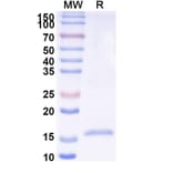 SDS-PAGE - Anti-Phosphoprotein Nanobody [SAA2104] (A338309) - Antibodies.com