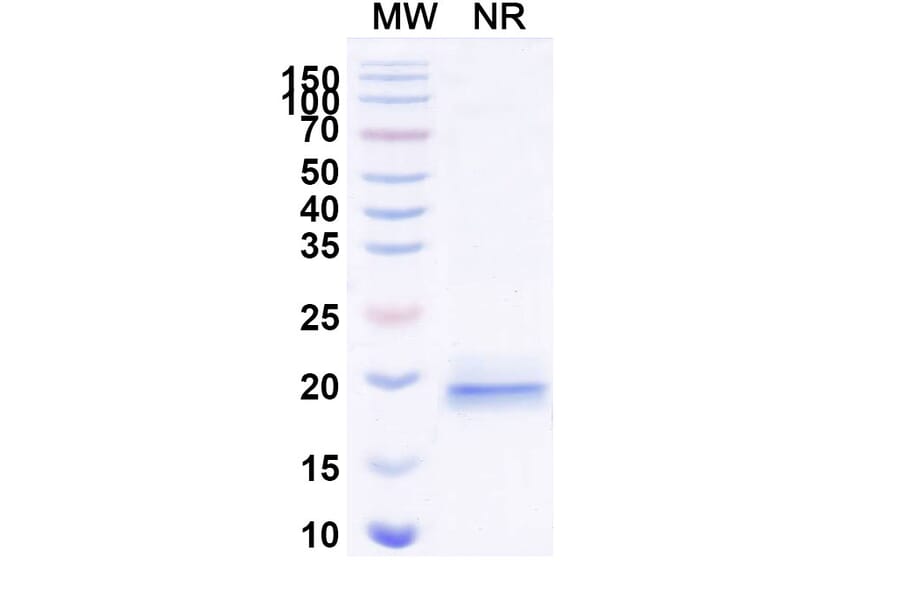 SDS-PAGE - Anti-VWF (ADAMTS13-Cleaved) Nanobody [KB-VWF-D3.1] (A338310) - Antibodies.com