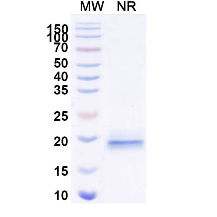 SDS-PAGE - Anti-VWF (ADAMTS13-Cleaved) Nanobody [KB-VWF-D3.1] (A338310) - Antibodies.com