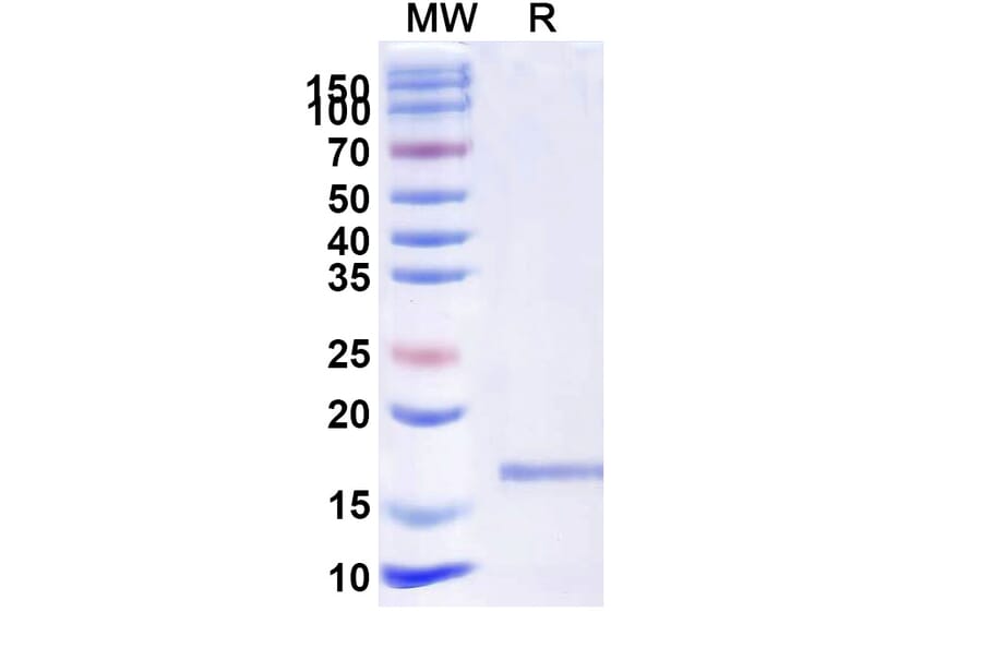 SDS-PAGE - Anti-VWF (ADAMTS13-Cleaved) Nanobody [KB-VWF-D3.1] (A338310) - Antibodies.com