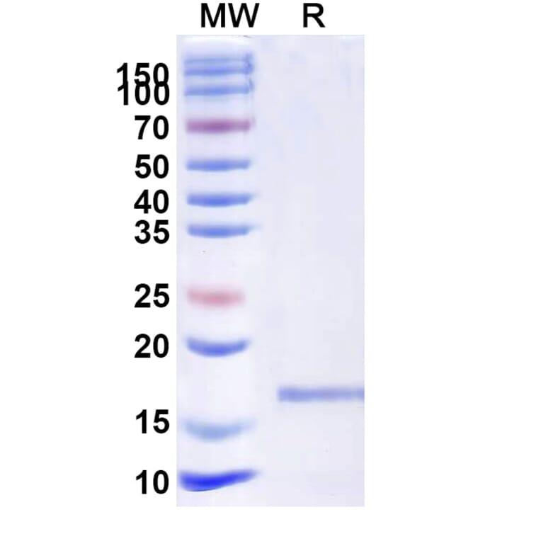 SDS-PAGE - Anti-VWF (ADAMTS13-Cleaved) Nanobody [KB-VWF-D3.1] (A338310) - Antibodies.com