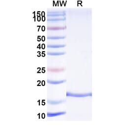 SDS-PAGE - Anti-VWF Nanobody [KB-VWF-F1.1] (A338311) - Antibodies.com