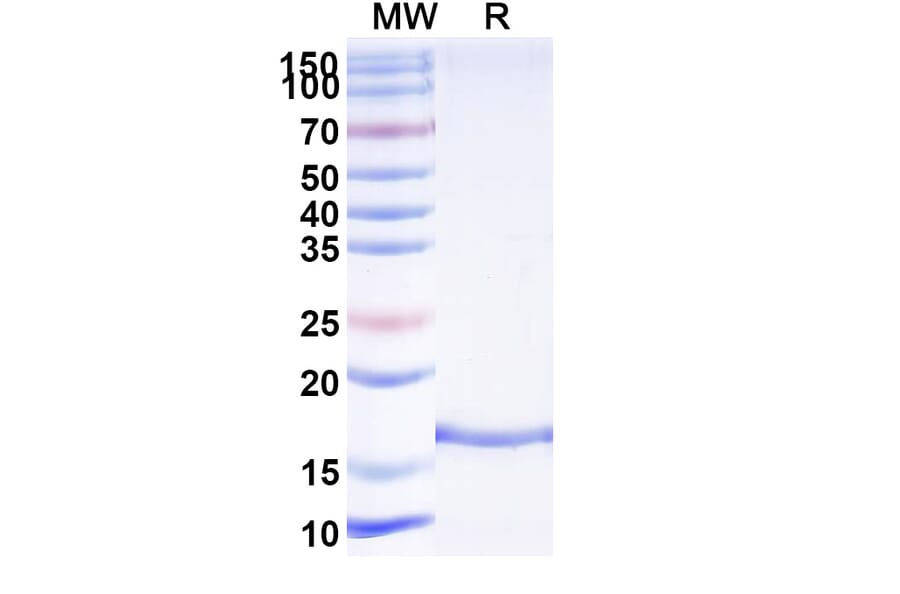 SDS-PAGE - Anti-VWF Nanobody [KB-VWF-F1.1] (A338311) - Antibodies.com