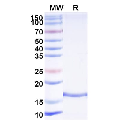 SDS-PAGE - Anti-VWF Nanobody [KB-VWF-F1.1] (A338311) - Antibodies.com
