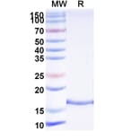 SDS-PAGE - Anti-VWF Nanobody [KB-VWF-F1.1] (A338311) - Antibodies.com