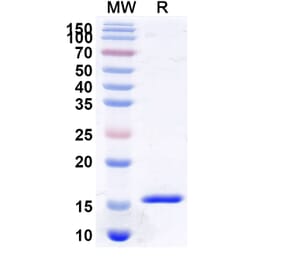 SDS-PAGE - Anti-VWF Nanobody [KB-VWF-006] (A338312) - Antibodies.com