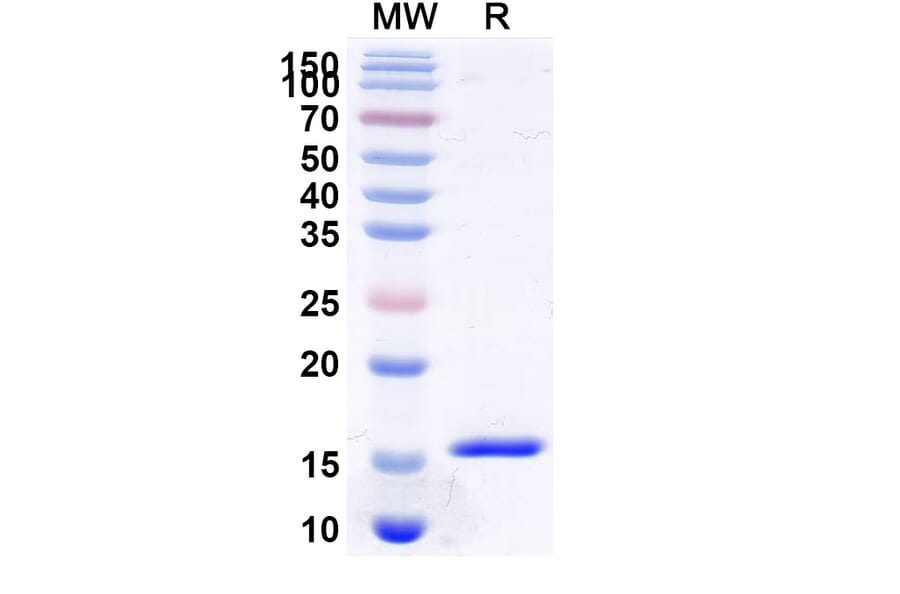 SDS-PAGE - Anti-VWF Nanobody [KB-VWF-006] (A338312) - Antibodies.com