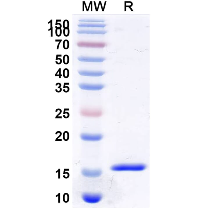 SDS-PAGE - Anti-VWF Nanobody [KB-VWF-006] (A338312) - Antibodies.com