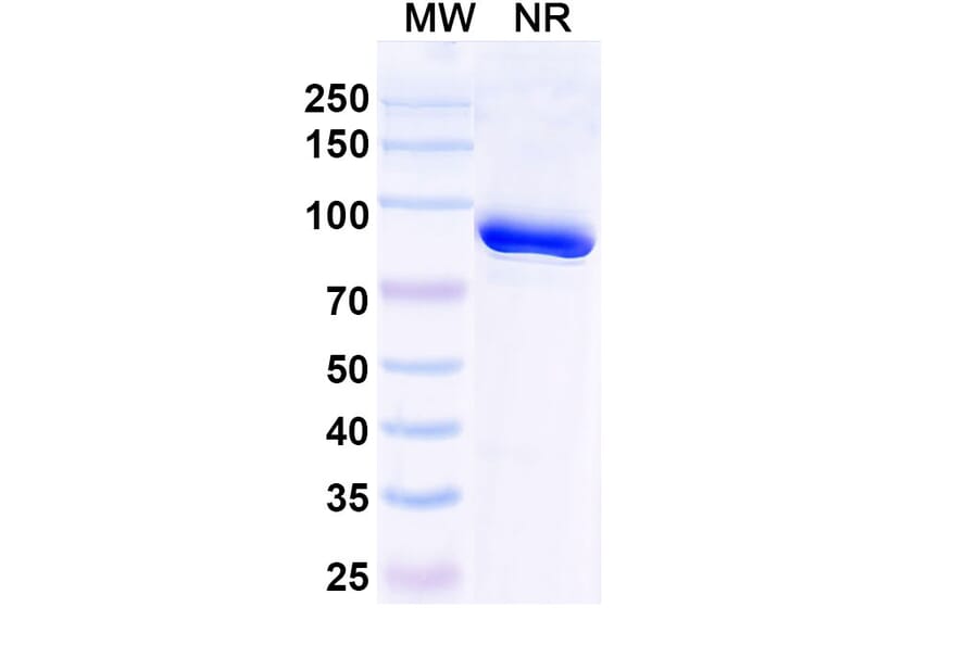 SDS-PAGE - Anti-Trastuzumab Nanobody [1HE] (A338316) - Antibodies.com