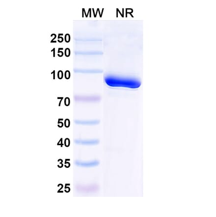 SDS-PAGE - Anti-Trastuzumab Nanobody [1HE] (A338316) - Antibodies.com