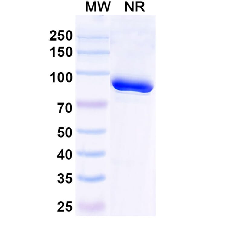 SDS-PAGE - Anti-Trastuzumab Nanobody [1HE] (A338316) - Antibodies.com