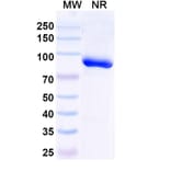 SDS-PAGE - Anti-Trastuzumab Nanobody [1HE] (A338316) - Antibodies.com