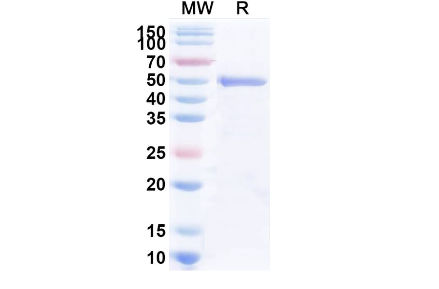 SDS-PAGE - Anti-Trastuzumab Nanobody [1HE] (A338316) - Antibodies.com