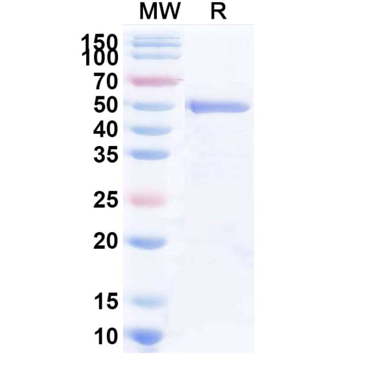 SDS-PAGE - Anti-Trastuzumab Nanobody [1HE] (A338316) - Antibodies.com