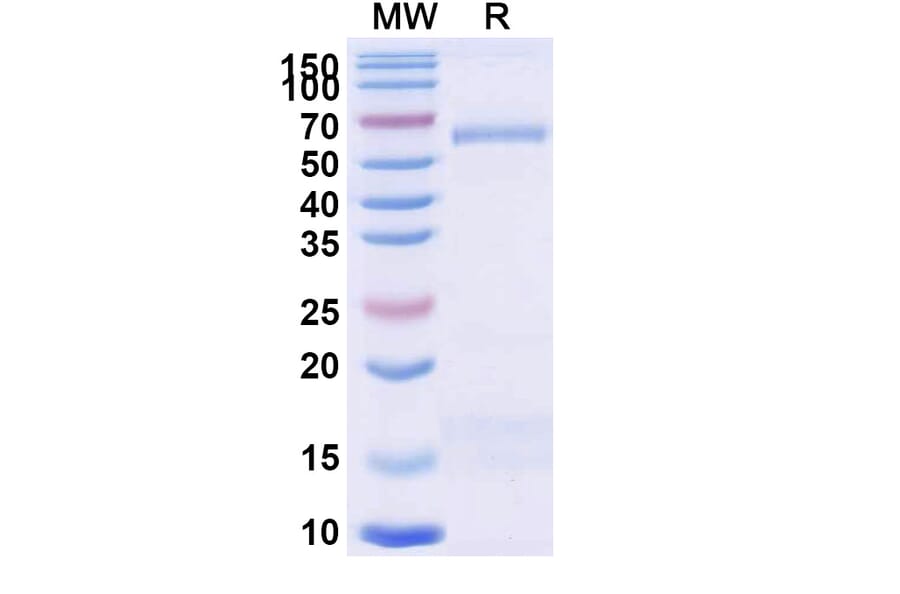 SDS-PAGE - Anti-Trastuzumab Nanobody [1HE] (A338316) - Antibodies.com