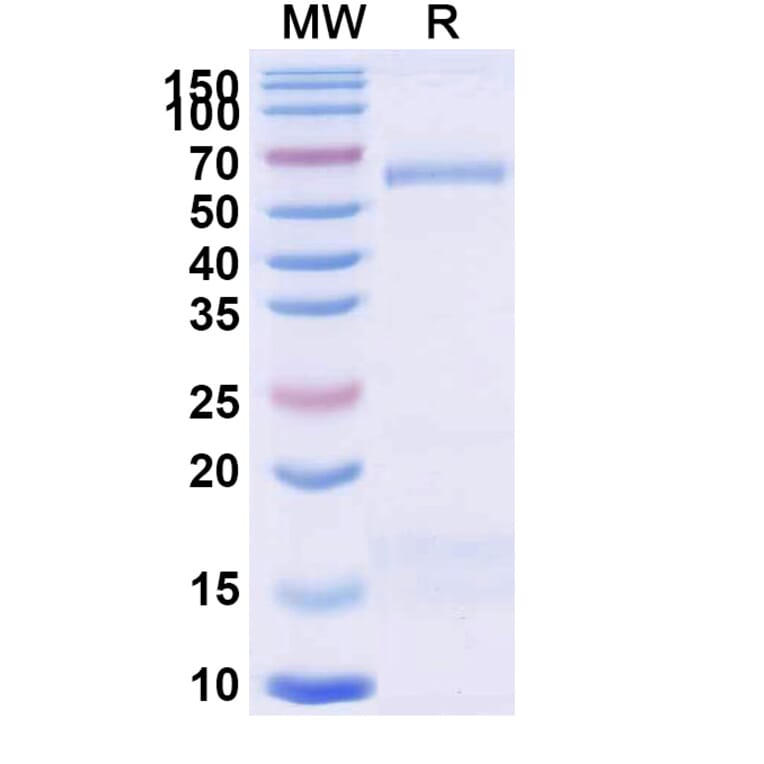 SDS-PAGE - Anti-Trastuzumab Nanobody [1HE] (A338316) - Antibodies.com