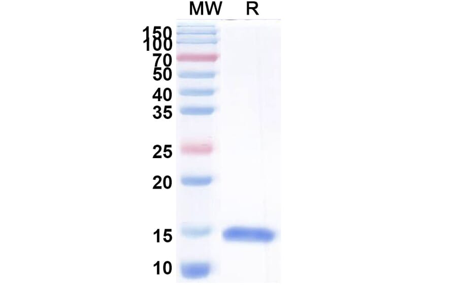 SDS-PAGE - Anti-ureB Nanobody [N01-C3] (A338317) - Antibodies.com