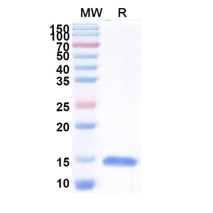 SDS-PAGE - Anti-ureB Nanobody [N01-C3] (A338317) - Antibodies.com