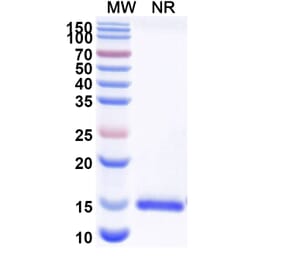 SDS-PAGE - Anti-Nectin 2 Nanobody [SAA2116] (A338321) - Antibodies.com