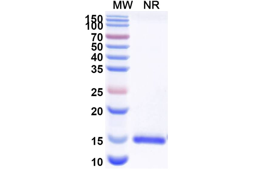 SDS-PAGE - Anti-Nectin 2 Nanobody [SAA2116] (A338321) - Antibodies.com