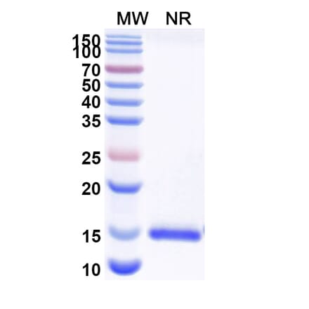 SDS-PAGE - Anti-Nectin 2 Nanobody [SAA2116] (A338321) - Antibodies.com