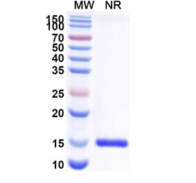 SDS-PAGE - Anti-Nectin 2 Nanobody [SAA2117] (A338322) - Antibodies.com
