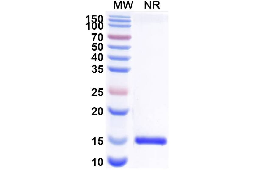 SDS-PAGE - Anti-Nectin 2 Nanobody [SAA2117] (A338322) - Antibodies.com